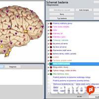 Borelioza-Plazmoterapia-Inhalacje Wodorowe H2-RifeMed Poznań