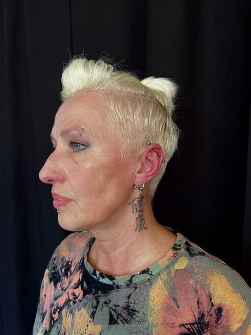 Tatuaż, Piercing, Laser Removal