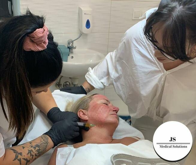 Kurs medycyny estetycznej Lublin szkolenie kwas hialuronowy