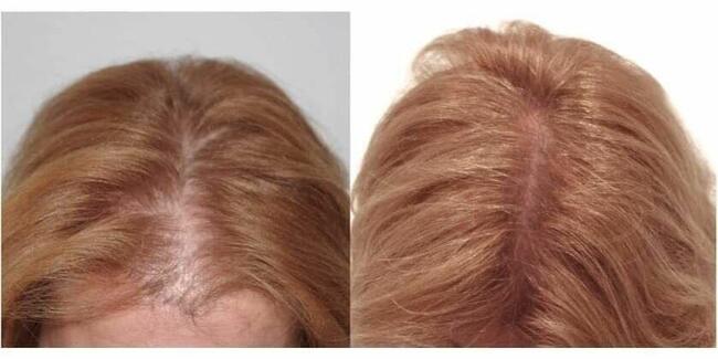 ZACZNIJ Z NAMI ZMIANĘ NA LEPSZE!