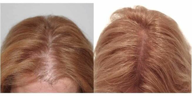 ZACZNIJ Z NAMI ZMIANĘ NA LEPSZE!