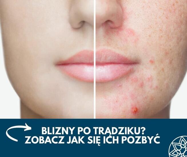 ZACZNIJ Z NAMI ZMIANĘ NA LEPSZE!