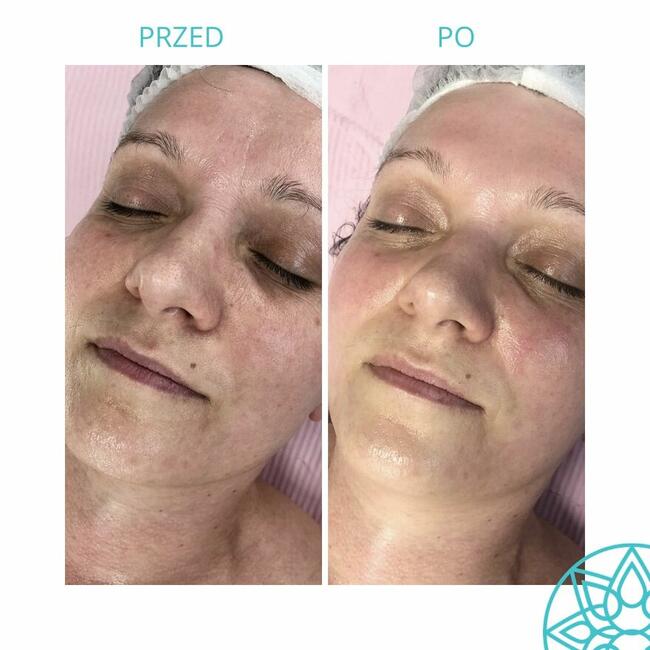 ZACZNIJ Z NAMI ZMIANĘ NA LEPSZE!