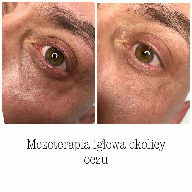 ZACZNIJ Z NAMI ZMIANĘ NA LEPSZE!