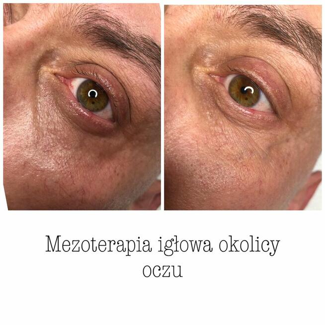 ZACZNIJ Z NAMI ZMIANĘ NA LEPSZE!