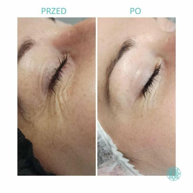 ZACZNIJ Z NAMI ZMIANĘ NA LEPSZE!