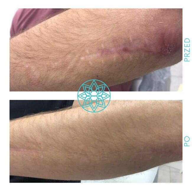 ZACZNIJ Z NAMI ZMIANĘ NA LEPSZE!