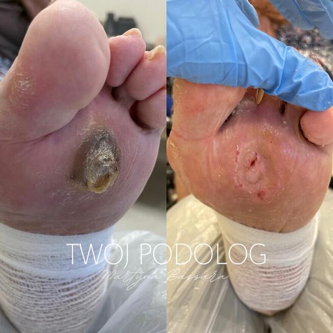 Pedicure dla Seniora Rzeszów i okolice