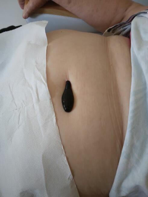 Masaz rehabilitacja pijawki terapia