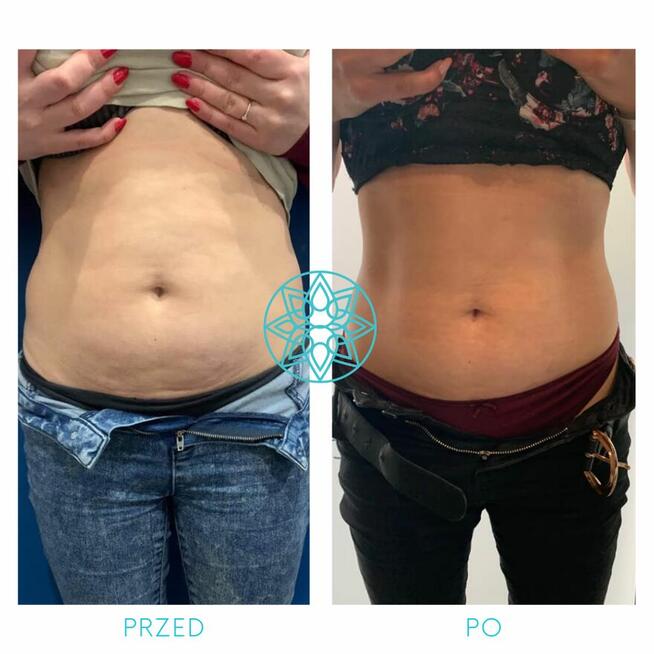 ZACZNIJ Z NAMI ZMIANĘ NA LEPSZE!