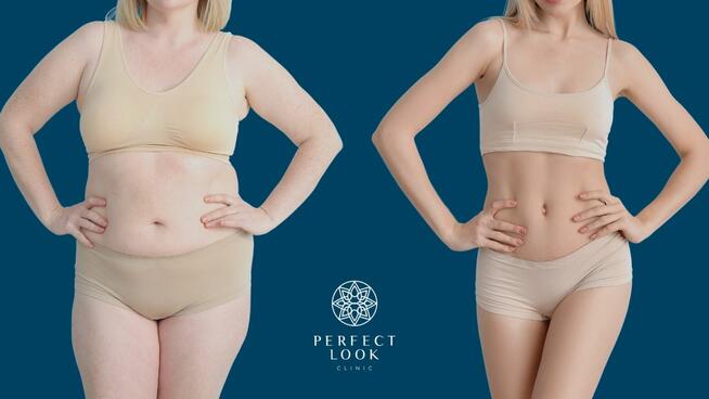 ZACZNIJ Z NAMI ZMIANĘ NA LEPSZE!