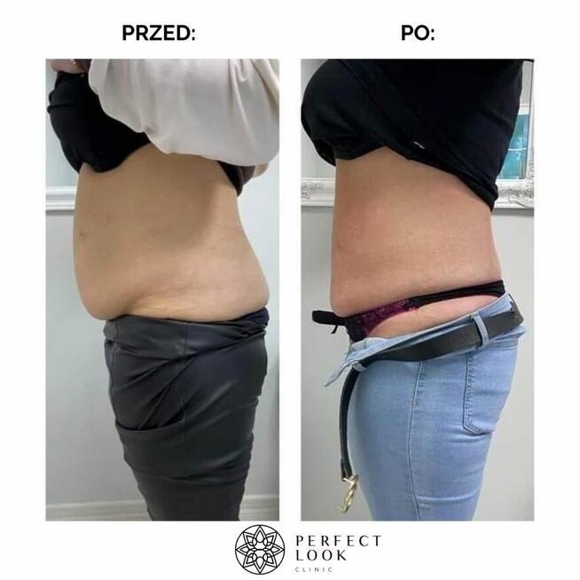 ZACZNIJ Z NAMI ZMIANĘ NA LEPSZE!