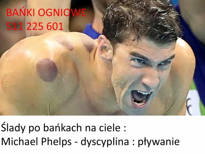 Bańki OGNIOWE w domu klienta - POBUDZENIE ODPORNOŚCI