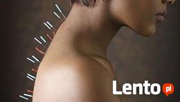 AKUPUNKTURA leczenie BÓLU, MIGREN, ZATOK, NAŁOGI, ODCHUDZANI