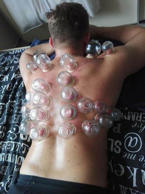 Stawianie baniek, Oczyszczanie zatok. Świecowanie uszu.