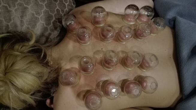 Stawianie baniek, Oczyszczanie zatok. Świecowanie uszu.