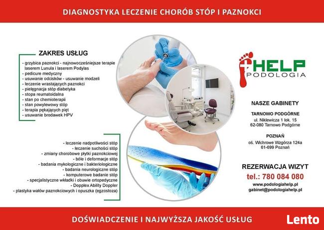 WKŁADKI ORTOPEDYCZNE Podologia HELP podolog TARNOWO Poznań