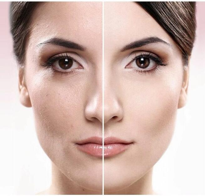 MASAŻER DO TWARZY AMAZEFAN MEZOTERAPIA