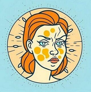 NATURALNA METODA NA ŁOJOTOKOWE ZAPALEBNIA SKÓRY ŁZS ŁUPIEŻ