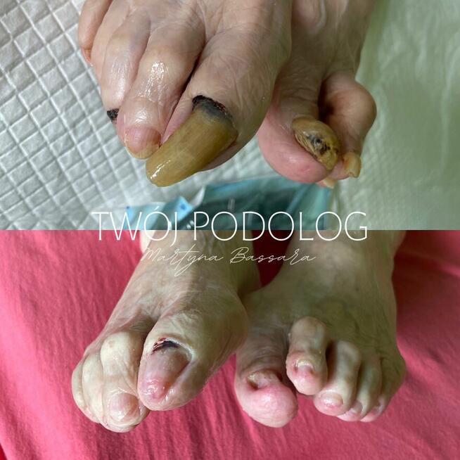 MOBILNY pedicure u klienta w domu