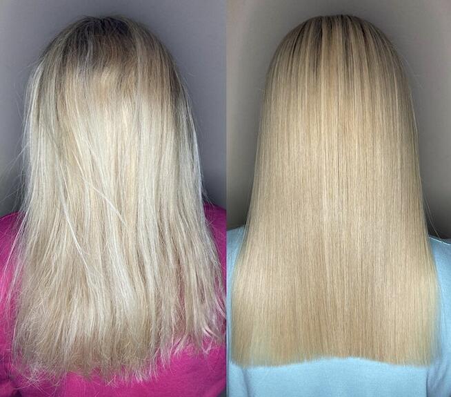 Keratynowe Prostowanie, Botoks z dojazdem Warszawa (okolice)