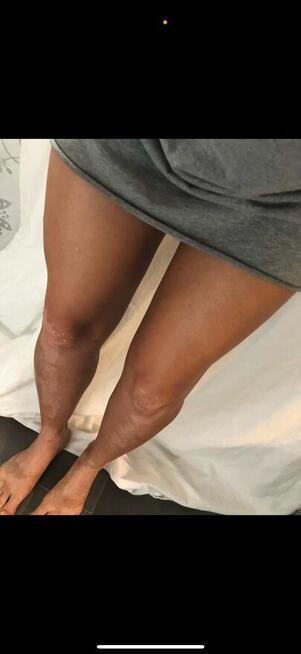 Opalanie Natryskowe z dojazdem do klienta Warszawa