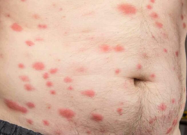 Dezynsekcja, Odpluskwianie, Deratyzacja, Dezynfekcja