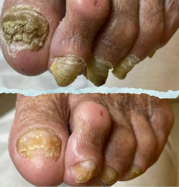 Usługi podologiczne mobilne