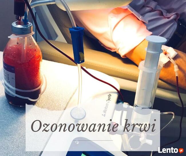 Glutation Kroplówki Dożylne Warszawa