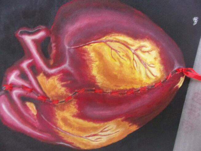 Obraz wyjątkowy ROZDARTE SERCE ale zszyte tasiemką