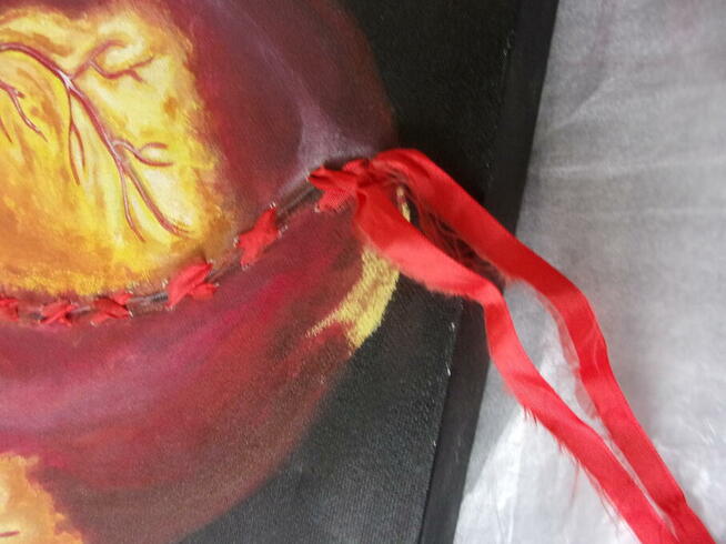 Obraz wyjątkowy ROZDARTE SERCE ale zszyte tasiemką