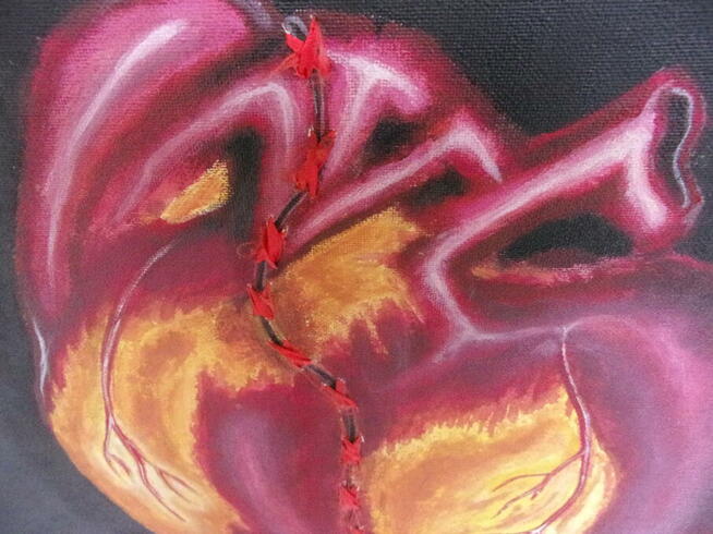 Obraz wyjątkowy ROZDARTE SERCE ale zszyte tasiemką