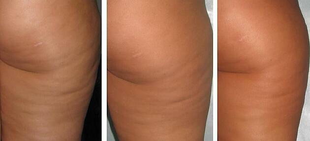 AKUPUNKTURA 140zł Usprawnianie płodności, bóle, rwą kulszowa