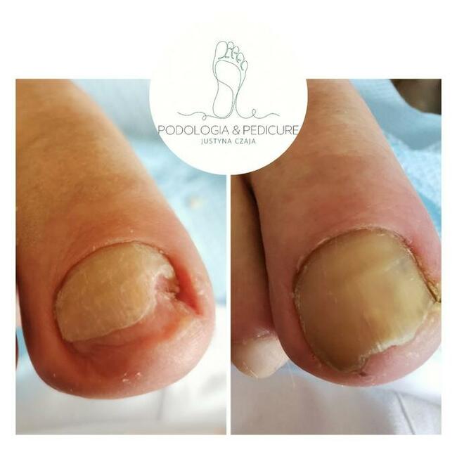 Podologia Justyna Czaja Gorzów Wielkopolski