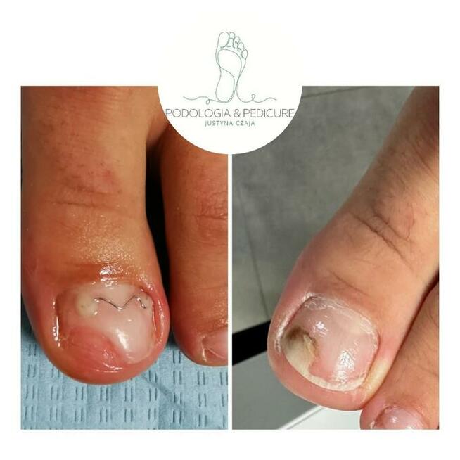 Podologia Justyna Czaja Gorzów Wielkopolski