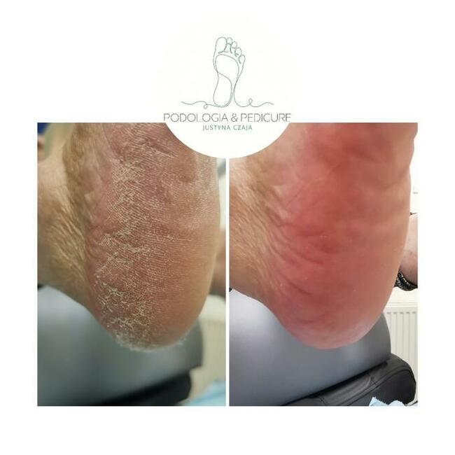 Podologia Justyna Czaja Gorzów Wielkopolski