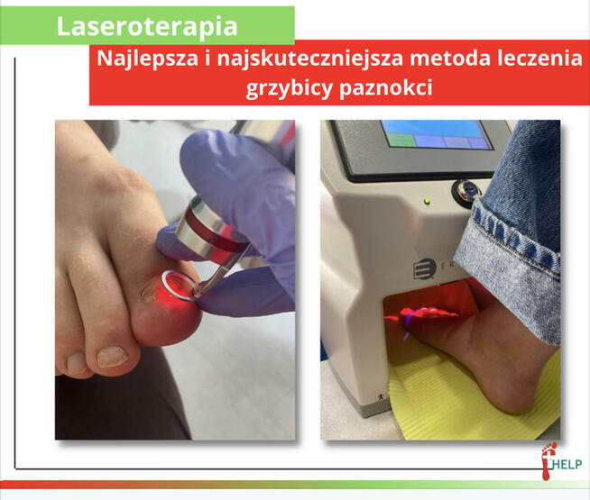 PODOLOGIA HELP TARNOWO Poznań Podolog