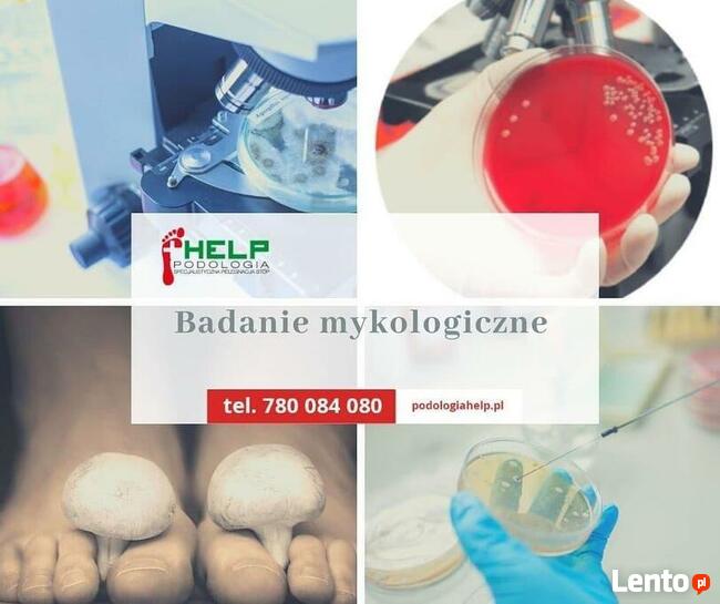 LASER - GRZYBICA - SKUTECZNIE POZNAŃ Tarnowo Podgórne