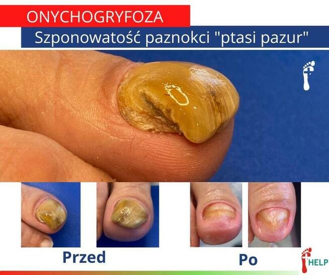 PODOLOGIA HELP TARNOWO Poznań Podolog