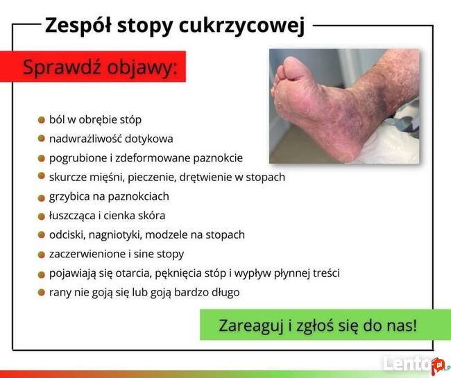 Podologia HELP PODOLOG Tarnowo Poznań