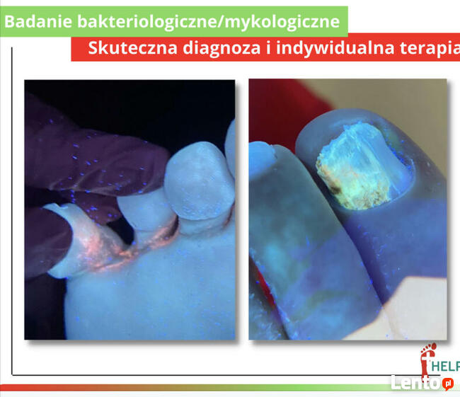 PODOLOGIA HELP TARNOWO Poznań Podolog