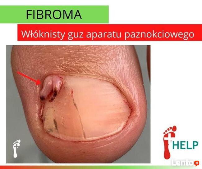 PODOLOGIA HELP TARNOWO Poznań Podolog