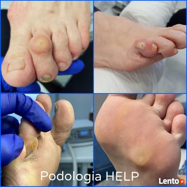 PODOLOGIA HELP TARNOWO Poznań Podolog