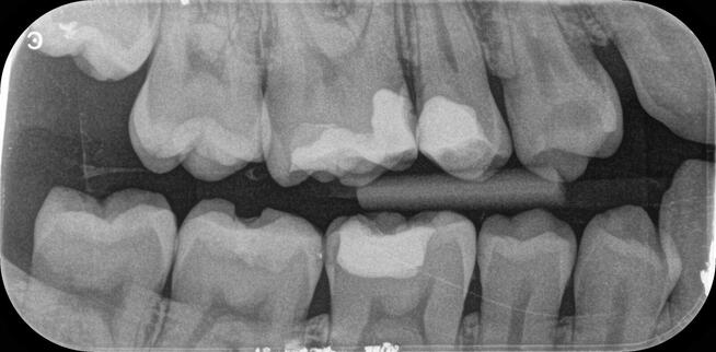 RTG panoramiczne, RTG Pantomograficzne, tel 694 336 219