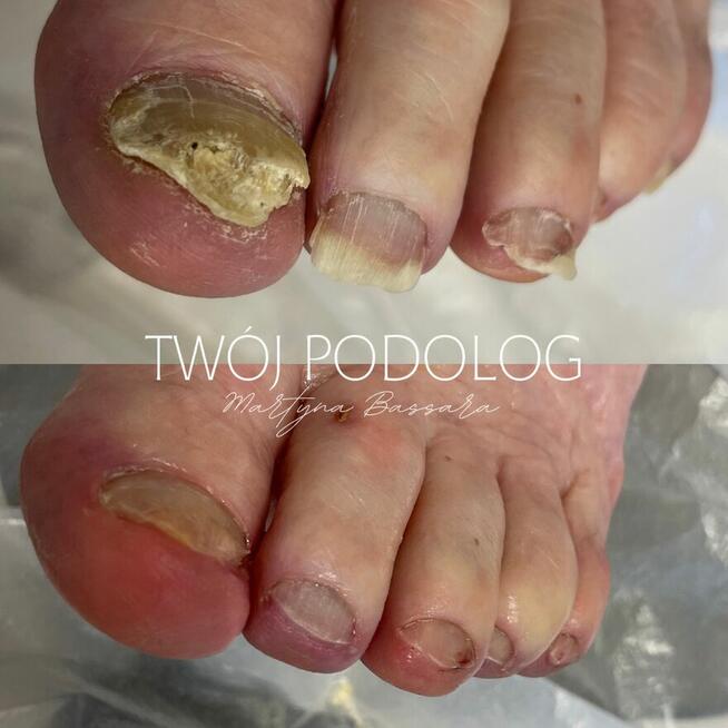 PODOLOG MOBILNY RZESZÓW I OKOLICE