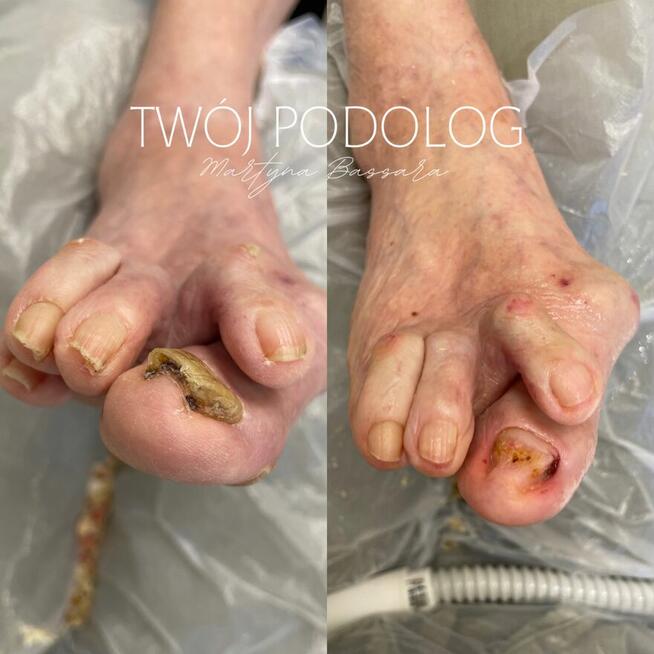 PODOLOG MOBILNY RZESZÓW I OKOLICE