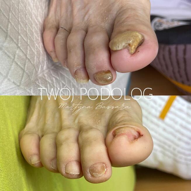 PODOLOG MOBILNY RZESZÓW I OKOLICE