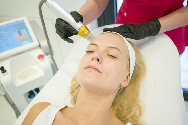 Radiofrekwencja mikroigłowa