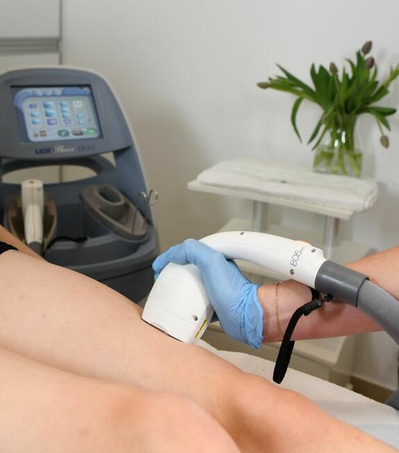 DEPILACJA LASEROWA KRAKÓW. PERFECT ESTETIC SALON KOSMETYCZNY