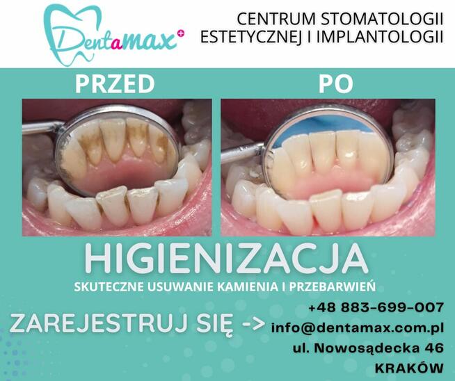 Bezpłatna konsultacja - Dentamax Nowosądecka 46 Kraków